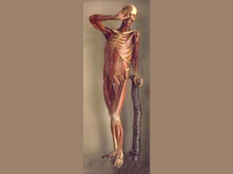 Bologna, Museo delle Cere Anatomiche "L. Cattaneo"