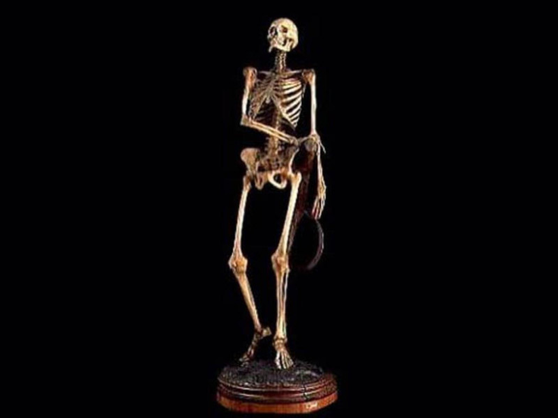 Bologna, Museo delle Cere Anatomiche "L. Cattaneo"