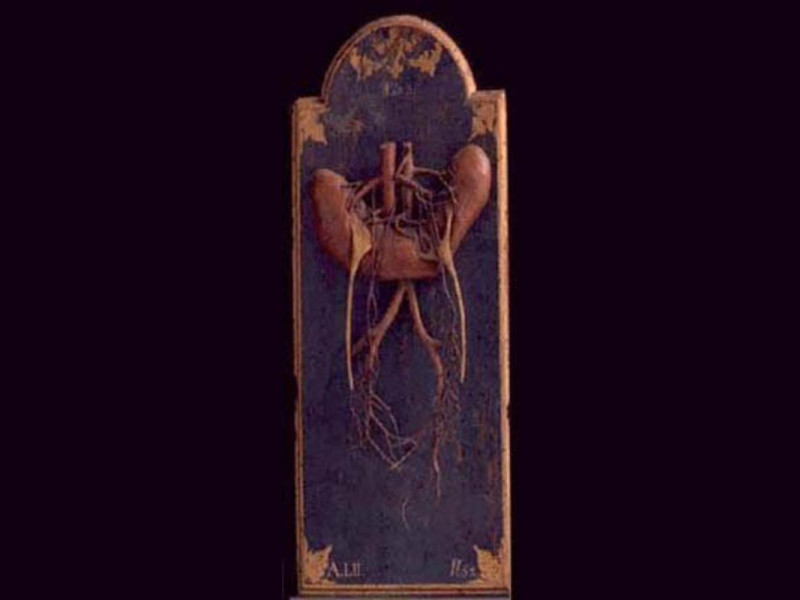 Bologna, Museo delle Cere Anatomiche "L. Cattaneo"