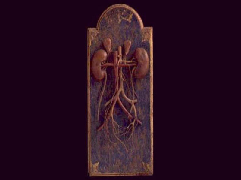 Bologna, Museo delle Cere Anatomiche "L. Cattaneo"