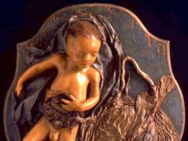 Bologna, Museo delle Cere Anatomiche "L. Cattaneo"