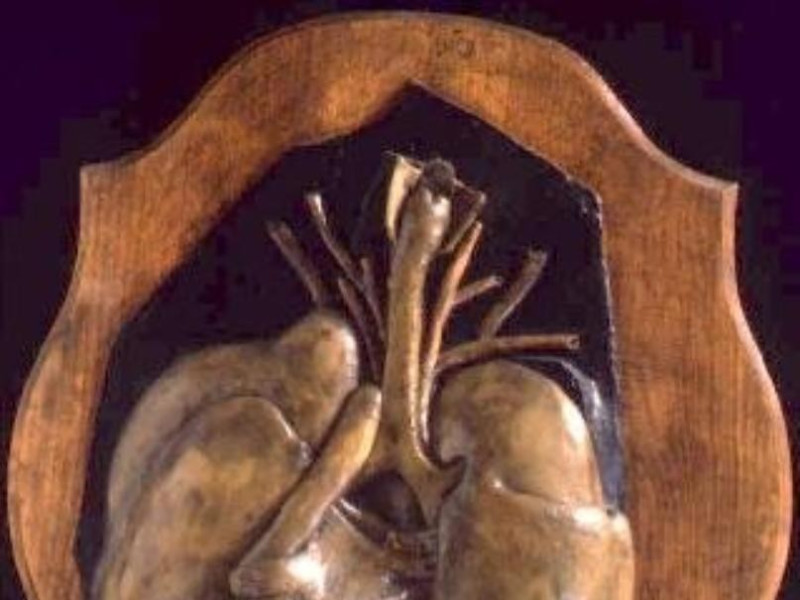 Bologna, Museo delle Cere Anatomiche "L. Cattaneo"