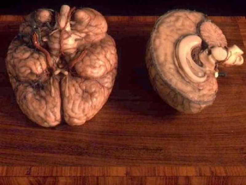 Bologna, Museo delle Cere Anatomiche "L. Cattaneo"