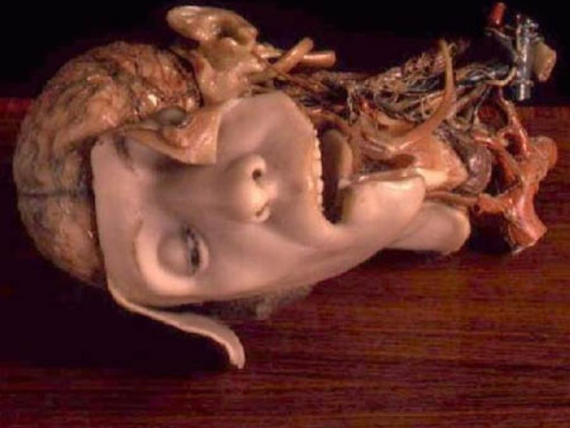 Bologna, Museo delle Cere Anatomiche "L. Cattaneo"