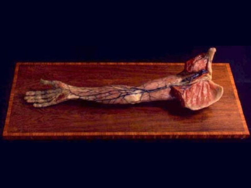 Bologna, Museo delle Cere Anatomiche "L. Cattaneo"