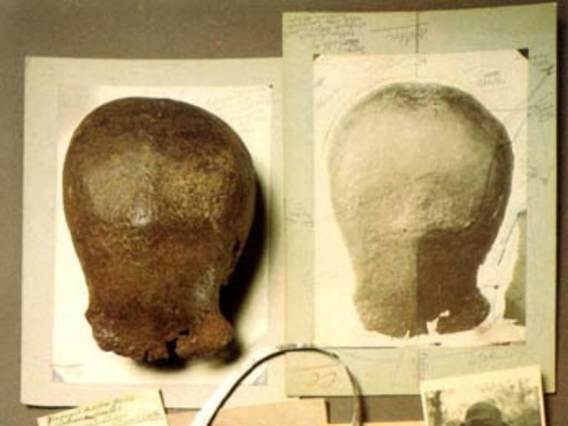 Bologna, Museo di Antropologia