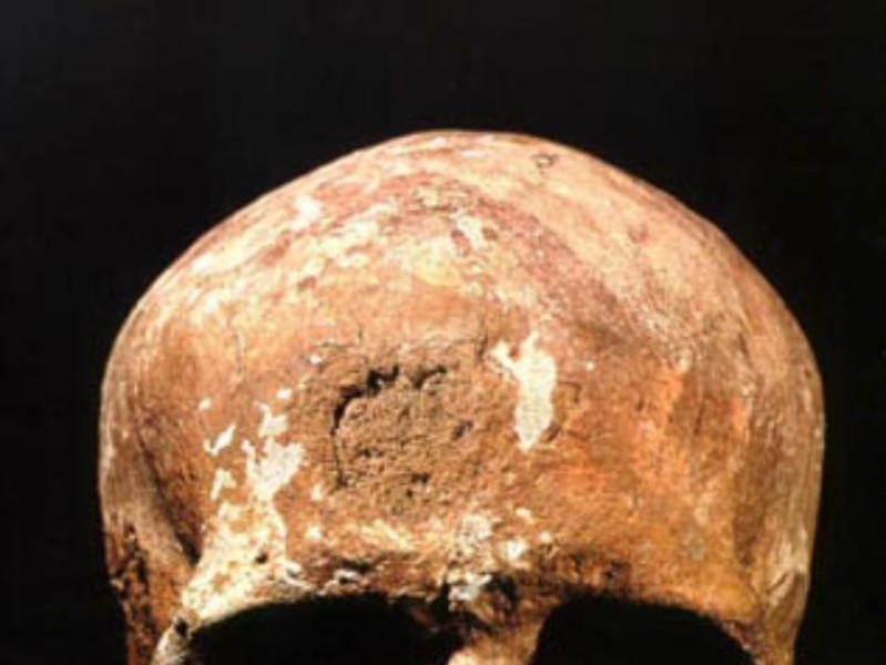 Bologna, Museo di Antropologia