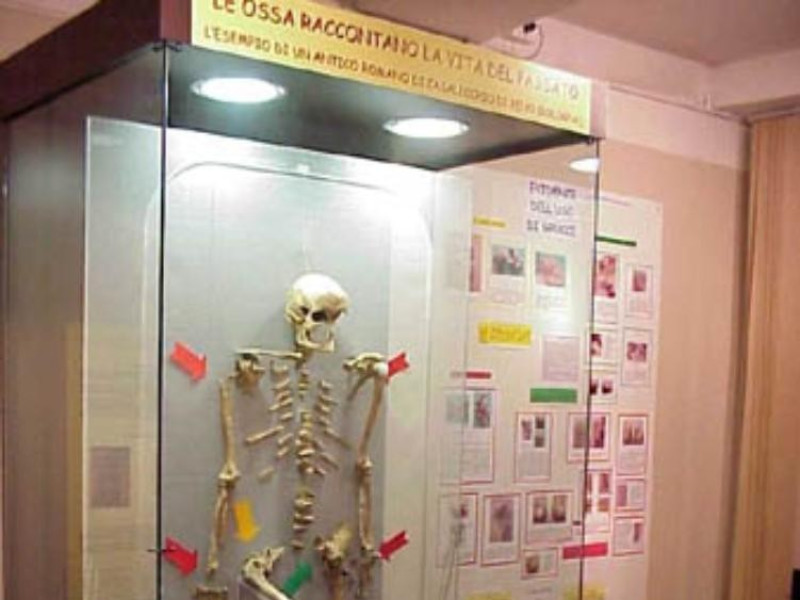 Bologna, Museo di Antropologia