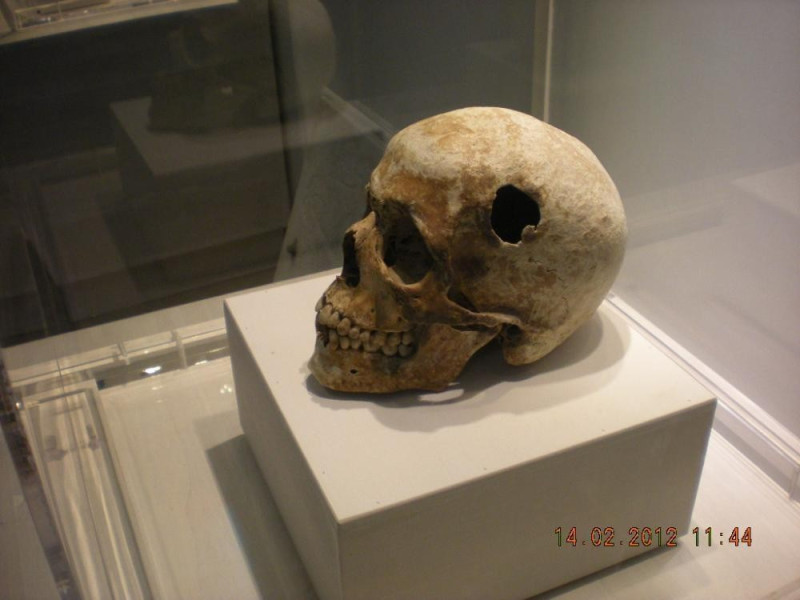 Studi anatomici di Baronio Vincenzi Bovini, Mirko; jpg; 1024 pixels; 768 pixels Studi anatomici di Baronio Vincenzi Bovini, Mirko; jpg; 1024 pixels; 768 pixels