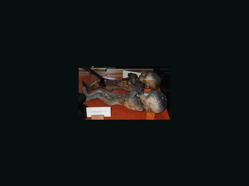 Collezione Anatomica Paolo Gorini (Lodi) ViaggiArt